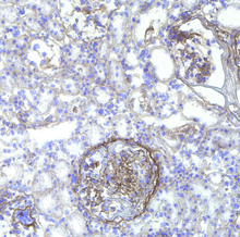 Load image into Gallery viewer, Stain with 3Helix B-CHP: Collagen Hybridizing Peptide, Biotin Conjugate.