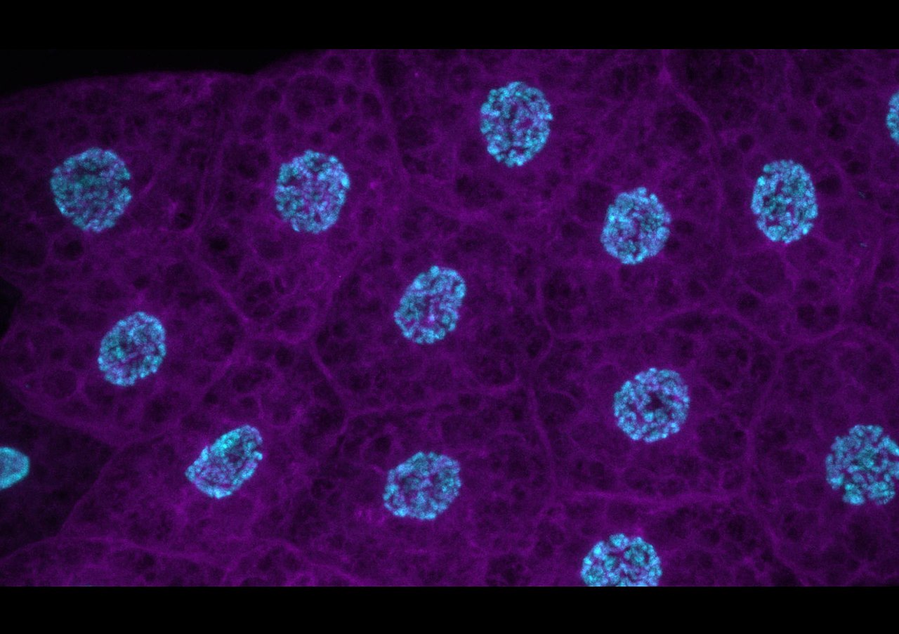 Cells In Insects Insect cells media | Cell culture – Ilex Life Sciences